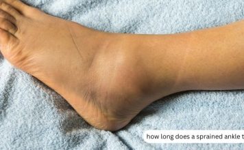 How Long Does It Take to Heal a Sprained Ankle? how long does a sprained ankle take to heal