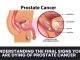 Understanding the Final Signs You Are Dying of Prostate Cancer Understanding the Final Signs You Are Dying of Prostate Cancer